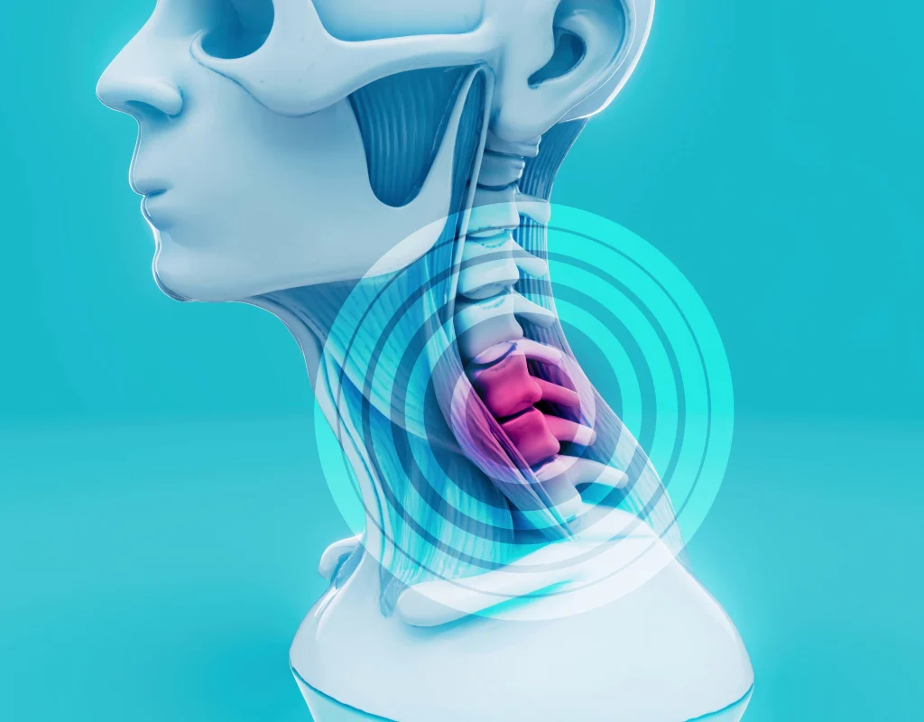tech neck relief cervical spine diagram